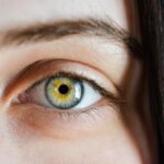 Augenlasern: Was man über die Behandlung wissen muss