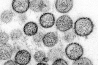 WHO: Hantavirus auf Schiff wurde von Mensch zu Mensch übertragen