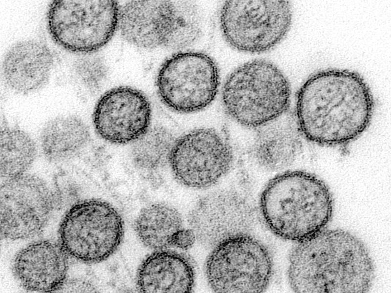 WHO: Hantavirus auf Schiff wurde von Mensch zu Mensch übertragen